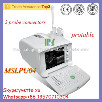 High quality Protable ultrasound machine Cheap ultrasound scanner come with abdominal probe MSLPU04M